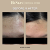 Be Confident Clay Masque (Oily/Acne-prone)