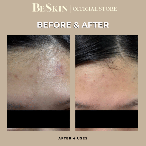 Be Confident Clay Masque (Oily/Acne-prone)