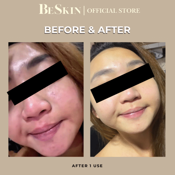 Be Radiant Clay Masque (Dry/Matured)
